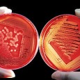 Image via Wikipedia Infections in human beings are caused by a frightening array of microorganisms. Bacteria, viruses, fungi, yeast, worms, amoeba, parasites, and prions invade the human body, spreading fear...