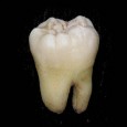   This blog post is contributed by a dentist colleague, who has offered to submit a series of posts about dental options when no dentist is around.  Thats, wh2thdr, for...