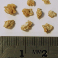 Kidney stones and the end of the world A kidney stone: don’t tell me it’s not the end of the world. Sure, I’m better today, but yesterday I was dying. At least it felt like it. I hadn’t...