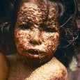 What would you do if . . . What would you do if . . . . . . a child approaches with a terrible-looking rash? . . . your wife is in labor and no help is available?...