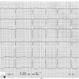 What would you do if . . . you develop chest pain? You’re 45 years old. You’ve been healthy – at least you think so. But suddenly, you awaken in the middle of the night with chest pain. You can’t call your...