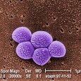 Antibiotics – 5 Reasons to Avoid Them – Yeast Infection, MRSA, Resistance, Diarrhea, and Allergy Have a cold? Take an antibiotic? Ear pain? Take an antibiotic. Acne? Take an antibiotic. That’s what people think anyway. But is this really the best course of action? Does...