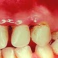 Trench Mouth and TEOTWAWKI Our friendly tooth doctor was inspired to write this after the Buckeyes beat Michigan. * * * As I have been thinking about what a dentist can add to a...