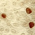In response to our first Question of the Week, KF sent this detailed information in support of her choice of the broad-spectrum antibiotic azithromycin. * * * Azithromycin in Brief...