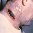 Photo Quiz Question – Q.001 – June 10, 2011 As this web site has developed I’ve continually tried to adapt it to the interests of my readers. At medical conferences,...