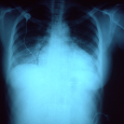 Lessons from Non-Compliant Patients I have seen patients die – from uncontrolled hypertension, treatable urinary infections, curable pneumonia. What do many of these patients have in common? Some (though not all) simply did not...