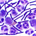 Could you diagnose anthrax on your own?  How about gonorrhea?  A Gram stain is often diagnostic, and can be performed with limited equipment.   The following post on clinical laboratory procedures is contributed...
