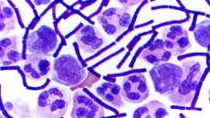 Could you diagnose anthrax on your own?  How about gonorrhea?  A Gram stain is often diagnostic, and can be performed with limited equipment.   The following post on clinical laboratory procedures is contributed...