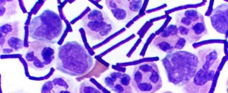 Could you diagnose anthrax on your own?  How about gonorrhea?  A Gram stain is often diagnostic, and can be performed with limited equipment.   The following post on clinical laboratory procedures is contributed...