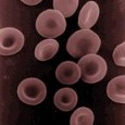 Clinical Laboratory Procedures under Austere Conditions: Part Va – Introduction to Doing a CBC with a Hemocytometer If the hospital lab is down, could you tell the difference between strep throat and mononucleosis by examing a patient’s blood? Could you differentiate between viral and bacterial pneumonia? Would you...