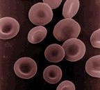 If the hospital lab is down, could you tell the difference between strep throat and mononucleosis by examing a patient’s blood? Could you differentiate between viral and bacterial pneumonia? Would you...