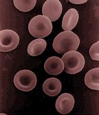 Clinical Laboratory Procedures under Austere Conditions: Part Va – Introduction to Doing a CBC with a Hemocytometer If the hospital lab is down, could you tell the difference between strep throat and mononucleosis by examing a patient’s blood? Could you differentiate between viral and bacterial pneumonia? Would you...