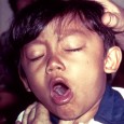 Tip of the Week: Bronchitis – Treat until you’re well? Say you have a bad cold. It’s gone to your chest and now you’re coughing up green gunk. It’s also starting to hurt when you cough and you’re a little short...