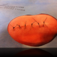 SPECIAL OFFER FREE DVD – BASIC SUTURING with Doc Cindy – with each Armageddon Medicine Resource Kit ordered  Or order Doc Cindy’s new DVD, Basic Suturing, to learn how to suture...