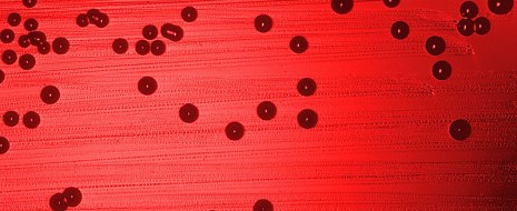 Medical Prepping in Three Months – A guide to safeguarding your family and loved ones – Weeks 2–3 Copyright © 2012 Cynthia J. Koelker, MD In Part 1 of this series (Week 1) we focused on assessment of needs and organization of your medical prepping plan. For Week...
