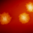 Treating life-threatening diarrhea after taking antibiotics If you fear that one day you may be on your own, and if you want to make sure you or a loved won’t die of diarrhea, you must know...