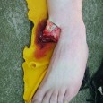 SURVIVAL MEDICINE 201 – Advanced New! Live Advanced Workshop with Doc Cindy Tuition only $365/person for 3 full days of instruction (9-4:30 daily) with Doc Cindy   2013 WORKSHOP SCHEDULE   Friday-Sunday, June 21-23,...